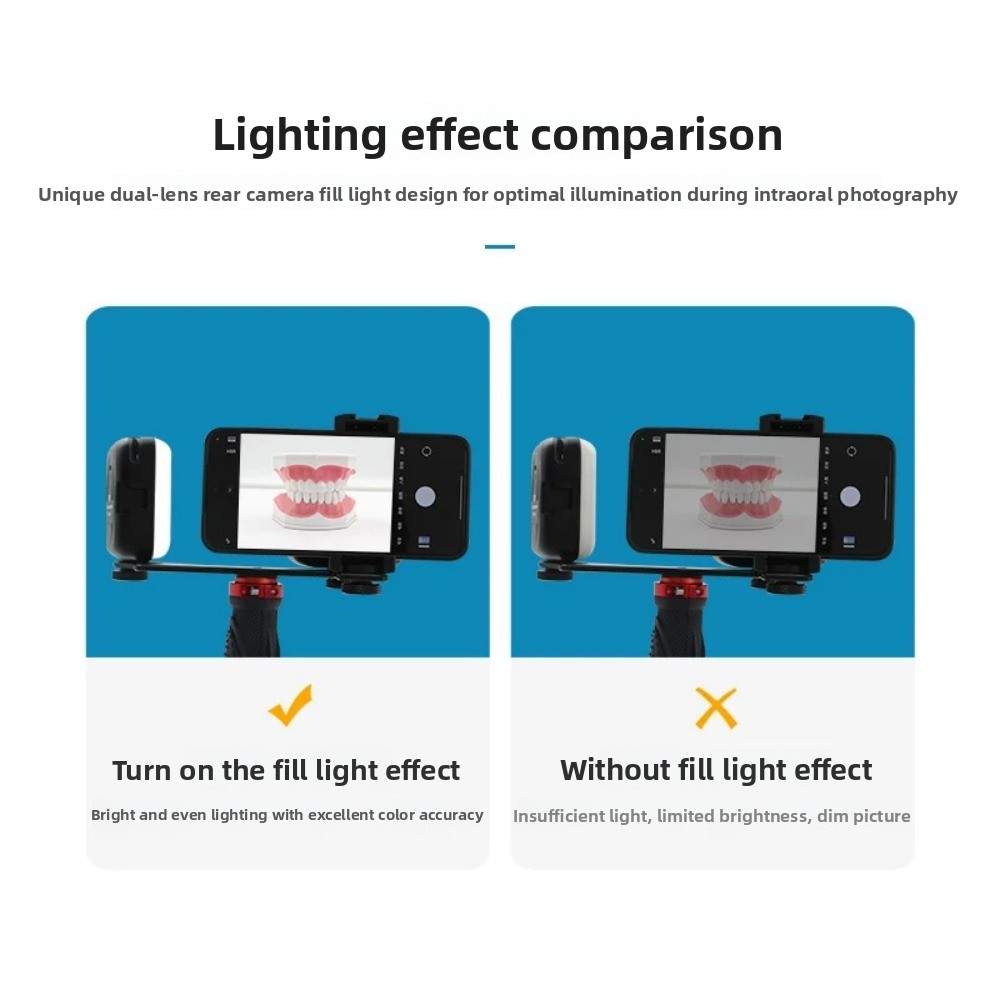 Dental Photography Light, Blue - Photography Basics 评论和价格